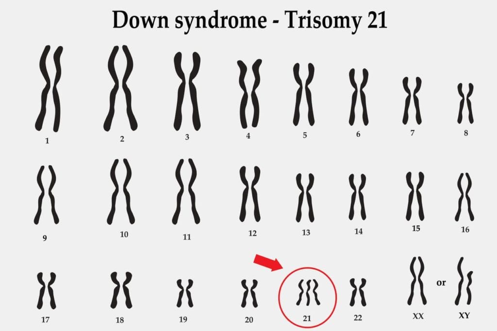 Trisomy 21 Tattoos